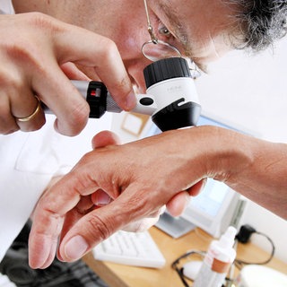 Arzt untersucht mit einer Lupe ein Muttermal auf Hautkrebs