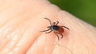 Zecken sind in diesem Jahr auf dem Vormarsch. Und mit ihnen die Fälle von Borreliose.