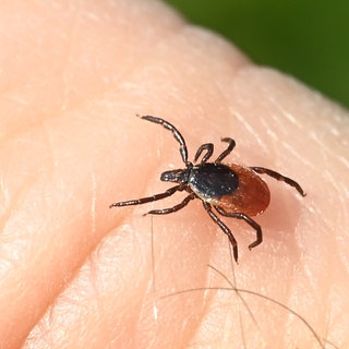 Zecken sind in diesem Jahr auf dem Vormarsch. Und mit ihnen die Fälle von Borreliose.