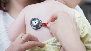 Ein kleines Kind wird am Rücken von einem Arzt mit dem Stethoskop abgehört 