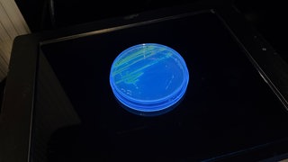 Für immunschwache Menschen und bei offenen Wunden kann der Krankenhauskeim Pseudomonas gefährlich werden. 