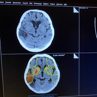 Die "Stroke-Unit" im Klinikum Ludwigshafen
