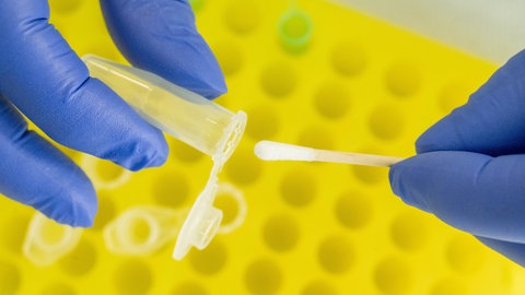 Im Labor einer Gerichtsmedizin werden DNA-Spuren untersucht (Symbolbild).