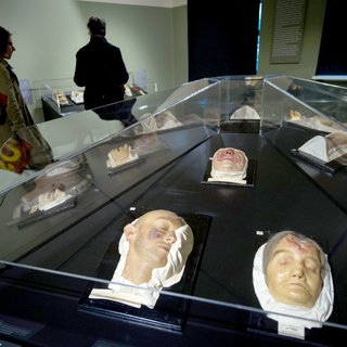 Die Syphilis kommt zurück, immer mehr Infektionen werden registriert. Wachsabdrücke, sogenannte Moulagen, die das Krankheitsbild Syphilis zeigen, liegen im Medizinhistorischen Museum Hamburg.