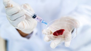 Fleisch wird im Labor untersucht