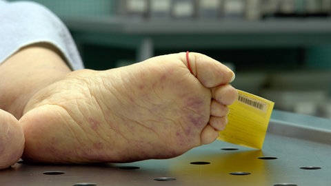 Rechtsmediziner warnen: Tausendfach bleiben in Deutschland Tötungsdelikte unerkannt