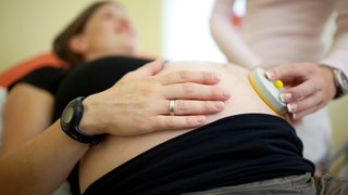 Messung der kindlichen Herztoene mit einem CTG-Gerät: Frauen erleben bei der Entbindung immer wieder Respektlosigkeit bis hin zu Gewalt. Der Tag der "Roses Revolution" erinnert jährlich am 25. November daran.