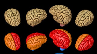 Grafische Ansicht von 20 Gehirnen, verschiedene Bereiche sind farblich gekennzeichnet: Unter Forschenden wird kontrovers diskutiert, ob sich die Denkorgane der Geschlechter grundsätzlich unterscheiden. Denn damit wird auch die Frage berührt, ob Männer und Frauen aus biologischen Gründen unterschiedlich denken, oder ob Unterschiede nur auf ihre Sozialisierung zurückzuführen sind.