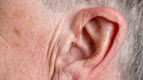 Moderne Hörgeräte sind so klein, dass sie, hinter dem Ohr platziert, kaum noch auffallen: Immer mehr Menschen sind schwerhörig, auch junge. Strategien für mehr Selbstbewusstein im Umgang mit der Krankheit, Technik-Neuerungen helfen. 