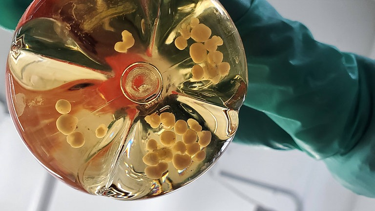 Ein Forscher hält eine Flasche mit Gehirnorganoiden in der Hand: In Organoiden, organähnlichen dreidimensionale Gewebestücken aus menschlichen Zellen, steckt großes Potenzial: An den "Mini-Organen" lassen sich Krankheiten untersuchen, neue Medikamente und Therapien entwickeln. Und möglicherweise schon bald die Anzahl der Tierversuche reduzieren.