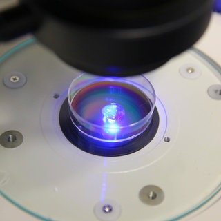 Das Bild zeigt eine Zebrafischlarve unter einem Fluoreszenzmikroskop.