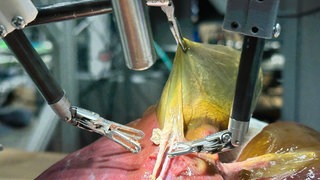 Roboter operiert selbständig an einer Schweine-Gallenblase