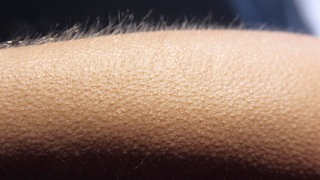 Gänsehaut in Nahaufnahme: Viele Menschen bekommen Gänsehaut, wenn sie bestimmte Musik hören. Häufig setzt die Gänsehaut ein, wenn der Refrain beginnt, die Musik auf einen Höhepunkt zusteuert oder wenn sie bei Nahaufnahmen im Film eingesetzt wird.