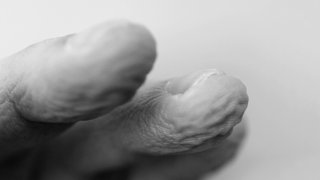 Schrumpelige Finger nach dem Baden: Die Standarderklärung für das Schrumpeln lautet, dass Hornhaut aufquillt. Doch möglicherweise steuert der Körper auch aktiv das Schrumpeln.