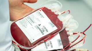 Mehrere Blutbeutel nach der Blutspende, sorgfältig nebeneinander angeordnet. Jeder Beutel ist mit Blut gefüllt und trägt ein Etikett mit Informationen wie Blutgruppe.