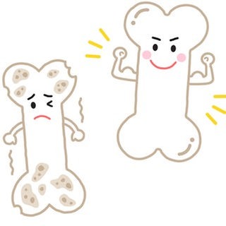 Osteoporose (Illustration): kranker "trauriger" Knochen und gesunder "fröhlicher" Knochen: Osteoporose betrifft in Deutschland rund 5,7 Millionen Menschen, vor allem Frauen nach der Menopause. Aber auch Männer kann es treffen. 