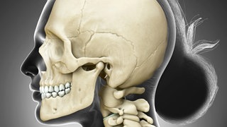 Weiblicher Schädel von der Seite: Es ist falsch zu denken, dass die großen Knochen die besonders harten sind. Denn der härteste Knochen im menschlichen Körper ist klein und von außen nicht sichtbar. Es ist das Felsenbein, das das Innenohr schützt.