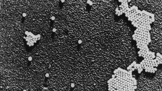 Das Poliomyelitis-Virus, die Ursache der Kinderlähmung, wurde 1908 von Karl Landsteiner entdeckt. Der Impfstoff gegen Polio wurde zwischen 1948 und 1953 entwickelt.