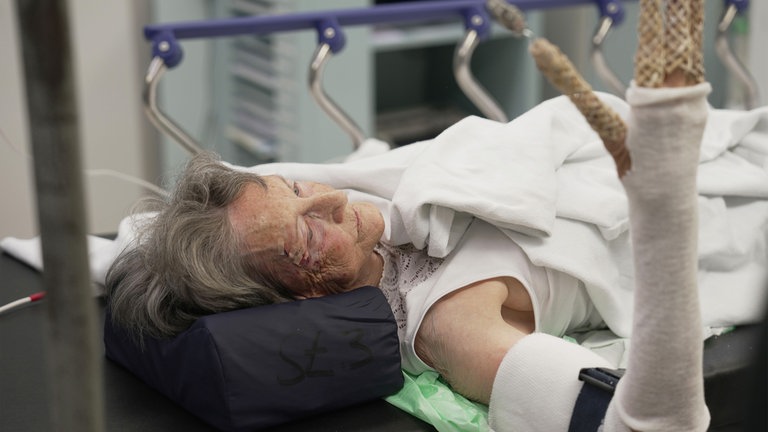Patientin mit schwerer Handverletzung