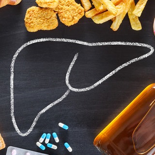 Stilisierte Kreidezeichnung einer Leber umgeben von ungesunden Lebensmitteln