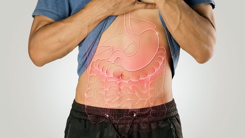 Reizdarmsyndrom (RDS): Bauchschmerzen, Durchfall, Verstopfung – ein Reizdarmsyndrom schränkt die Lebensqualität stark ein. Das Leiden lässt sich nicht heilen, aber lindern - etwa mit der richtigen Diät ohne Fodmap.