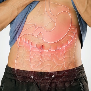 Reizdarmsyndrom (RDS): Bauchschmerzen, Durchfall, Verstopfung – ein Reizdarmsyndrom schränkt die Lebensqualität stark ein. Das Leiden lässt sich nicht heilen, aber lindern - etwa mit der richtigen Diät ohne Fodmap.