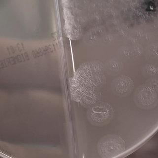 Multiresistente Keime – wie man sich schützt