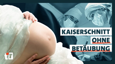 Kaiserschnitt im OP